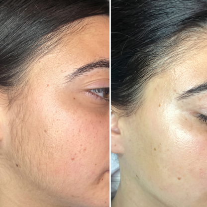 Wiki Hair Blocker Cream Smooth & Hair-Free Skin Solution