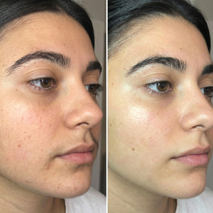 Wiki Hair Blocker Cream Smooth & Hair-Free Skin Solution